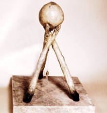 Bronze Asparagus tpee 2nd view
